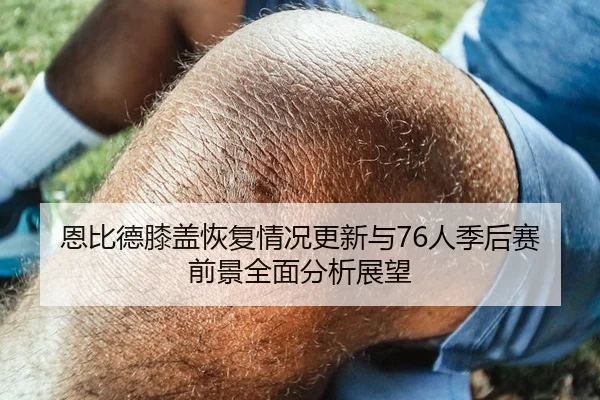 恩比德膝盖恢复情况更新与76人季后赛前景全面分析展望